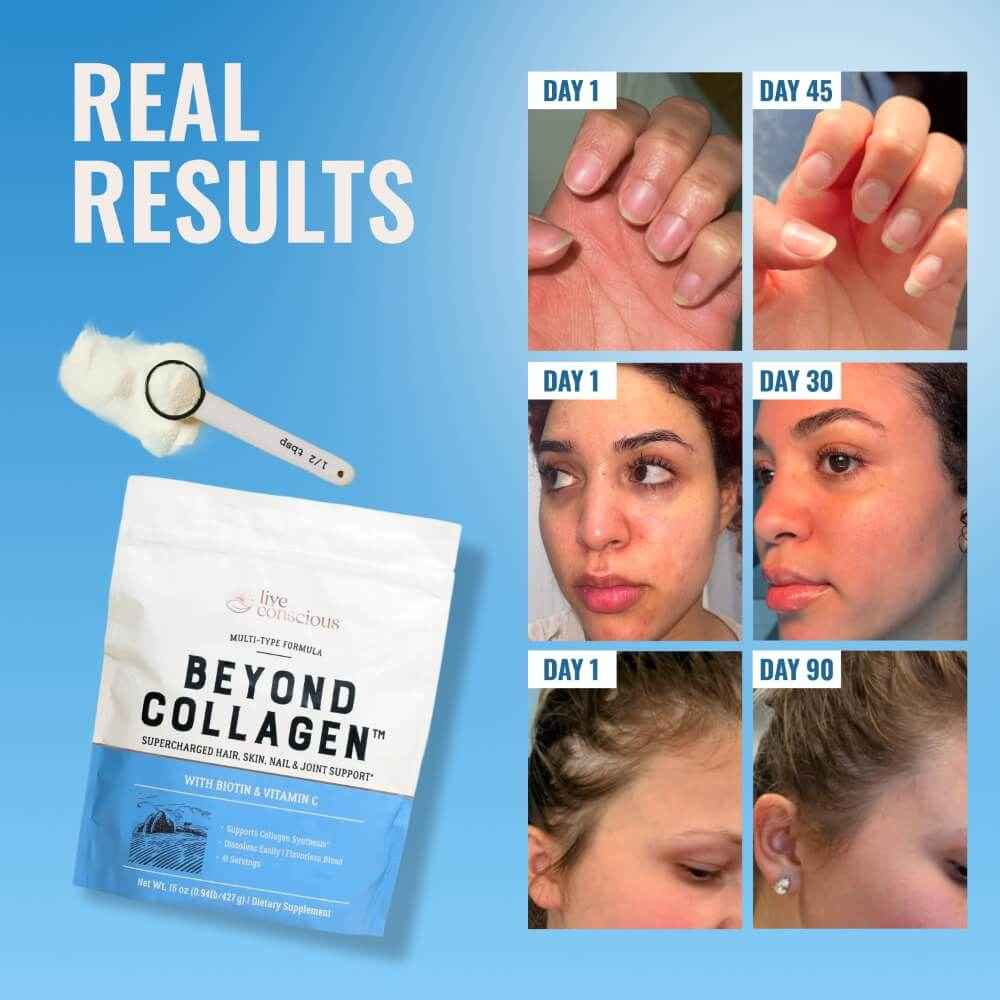 Beyond Collagen